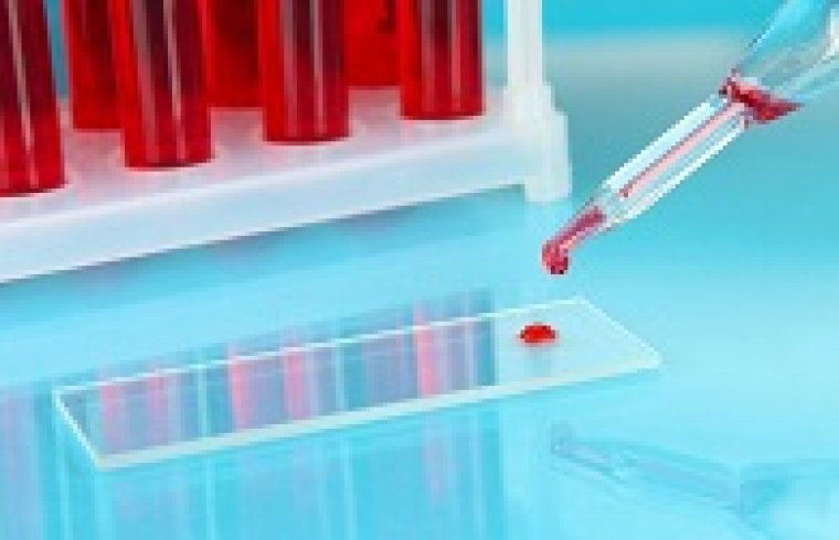 Determinación de endotoxinas en plasma sanguíneo mediante el método de LAL